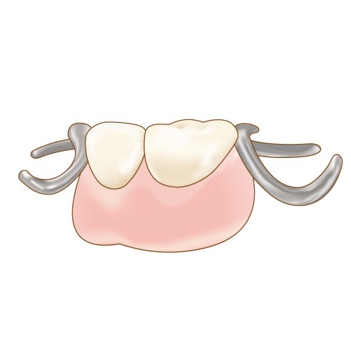 部分入れ歯について