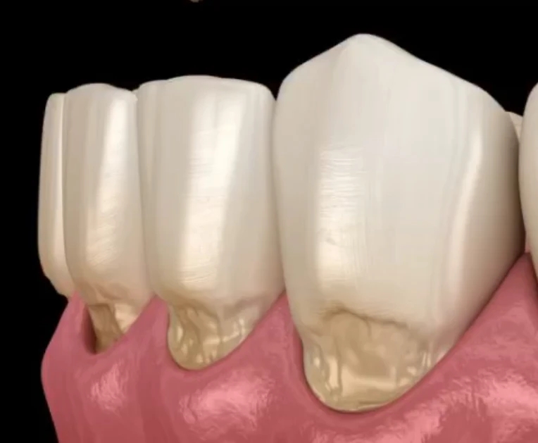 ハブラシの方法間違っていませんか？