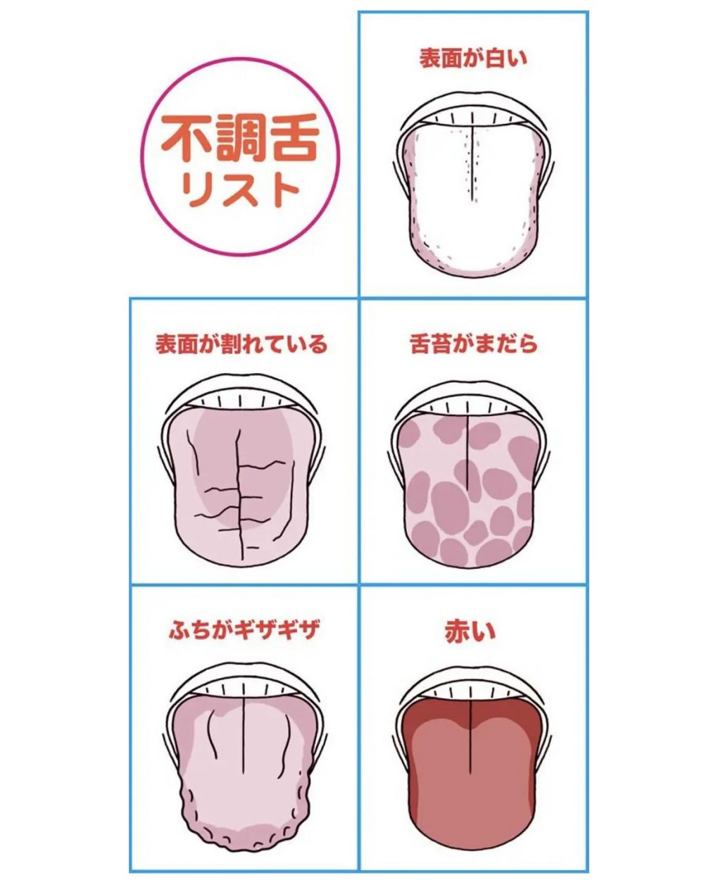 舌は健康のバロメーター