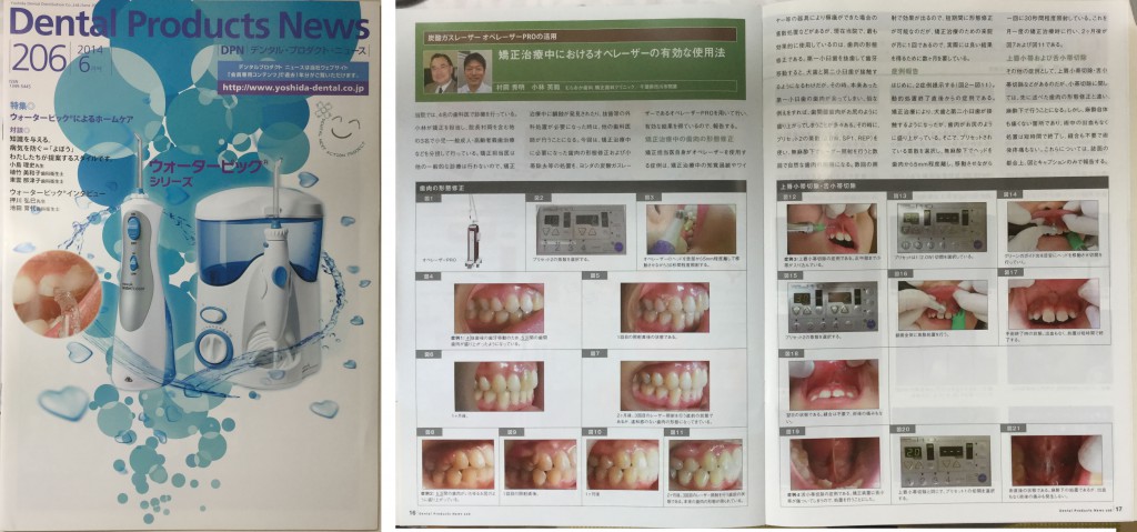 Dental Product News