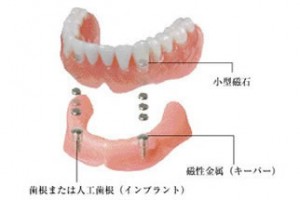 マグネットプデンチャー